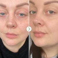 Rosehip Bioregenerate™ Duo